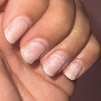 Abeille Nail - Over filing damage - Nail Salons Near Me - Costa Mesa, California Abeille Nail - Over filing damage - Nail Salons Near Me - Costa Mesa, California
