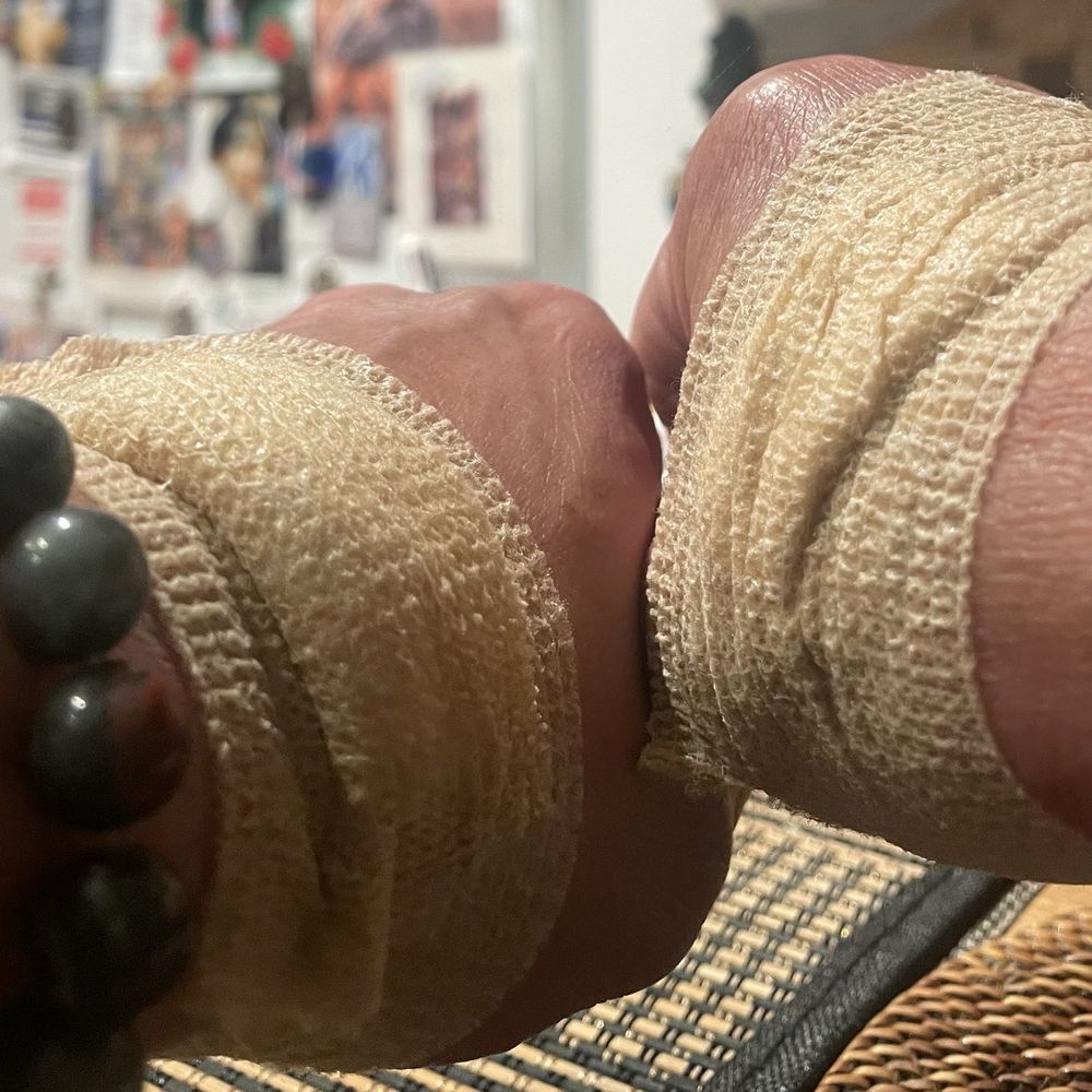 Labcorp - Hurting hands after blood  was drawn. - Laboratory Testing Near Me - San Ramon, California
