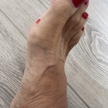 Select Nails & Spa - Raw flesh from pedicure. Not even an apology! - Nail Salons Near Me - Phoenix, Arizona