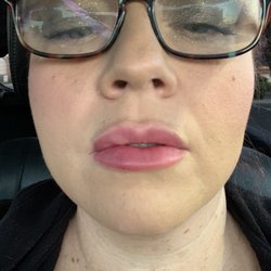 Ideal Image Peoria - Uneven!! Help me