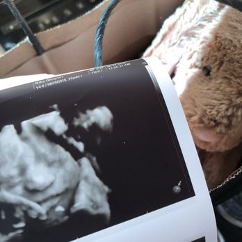 Baby Glimpses - Diagnostic Imaging Near Me - Bakersfield, California Baby Glimpses - Diagnostic Imaging Near Me - Bakersfield, California
