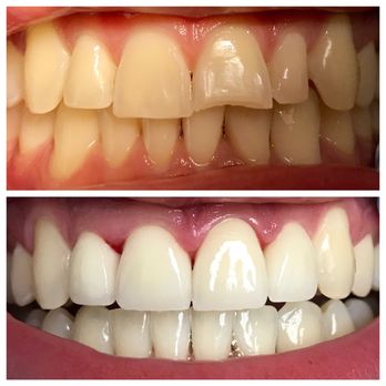 Oleg Kruglyansky DDS - Cosmetic Dentists Near Me - Brooklyn, New York