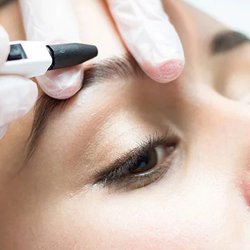 Electrology by Jessica - Electrolysis of the eyebrow being performed