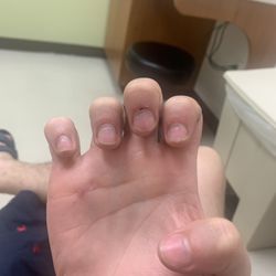 Victoria Nails - Middle finger started bleed again today