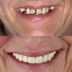 Ace Dental of West New York