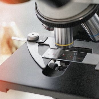 Vitality Wellness Center - Live Blood Analysis allows us to get to the root causes effectively - Traditional Chinese Medicine Near Me - Langley, British Columbia Vitality Wellness Center - Live Blood Analysis allows us to get to the root causes effectively - Traditional Chinese Medicine Near Me - Langley, British Columbia