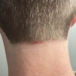 Great Clips - Even broke the skin.