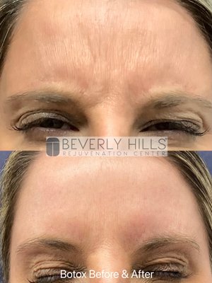 Beverly Hills Rejuvenation Center Westlake Village by null