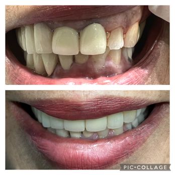 DJ Dental Group - Cosmetic Dentists Near Me - La Palma, California DJ Dental Group - Cosmetic Dentists Near Me - La Palma, California