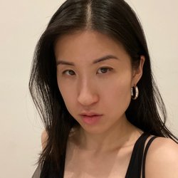 Marina Zakhrabova - After 2 weeks fully healed