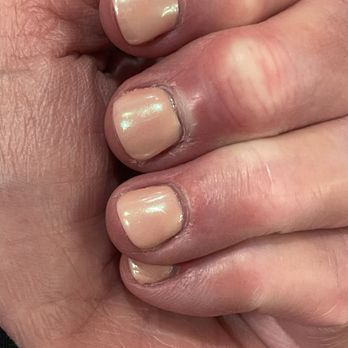 California Nails - Nails first time and then after they were "fixed" - Nail Salons Near Me - Orlando, Florida