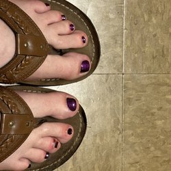 Pro Nails - Cellulitis day two