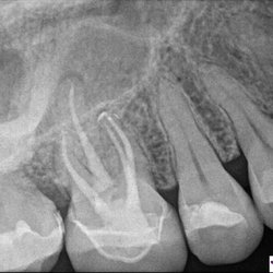 Natanya Marracino, DMD - Mill Valley Endodontics