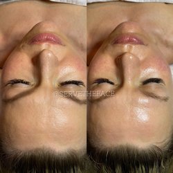 SERVETHEFACE - Before & after