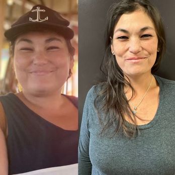 Signature Med Spa - Weight Loss Progression - Medical Spas Near Me - Torrance, California Signature Med Spa - Weight Loss Progression - Medical Spas Near Me - Torrance, California