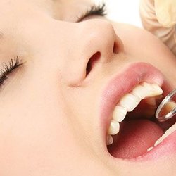 Implant Dental - Implant Dental | Plattsburgh, NY