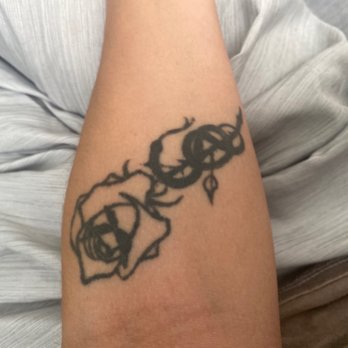LaserAway - Tattoo Removal Near Me - Fort Lauderdale, Florida LaserAway - Tattoo Removal Near Me - Fort Lauderdale, Florida