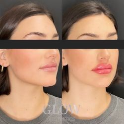 Glow Aesthetics Bar