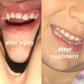 Robert J Valdez, DDS - Thank you Dr Wilson! - Pediatric Dentists Near Me - Whittier, California