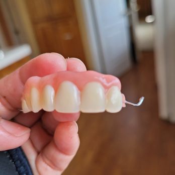 Castronova Smile Lab - Partial Denture - Cosmetic Dentists Near Me - Napa, California Castronova Smile Lab - Partial Denture - Cosmetic Dentists Near Me - Napa, California