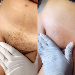 Wax It By Asia - Before and After Brazilian Wax