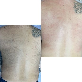 Beauty Pro By Jane - Full back - Waxing Near Me - Valrico, Florida Beauty Pro By Jane - Full back - Waxing Near Me - Valrico, Florida