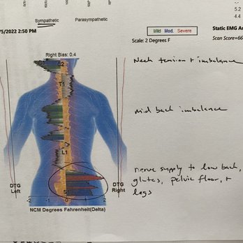 Activate Chiropractic A Family Wellness Center - No wonder I've been in pain for so long! - Chiropractors Near Me - Poway, California Activate Chiropractic A Family Wellness Center - No wonder I've been in pain for so long! - Chiropractors Near Me - Poway, California