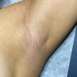 Novelty Beauty - Underarm Sugaring