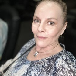 3 Months after Fibroblast Facelift Treatment- No Wrinkles -My Skin looks Flawless for being 55 years old.