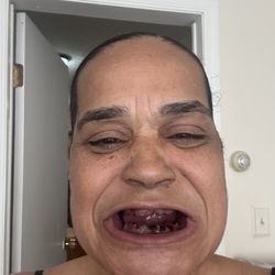 Limitless Dental Jersey City - Removed all my teeth and left me in pain