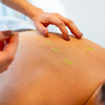 Kai Wellness - Acupuncture - Acupuncture Near Me - Los Angeles, California Kai Wellness - Acupuncture - Acupuncture Near Me - Los Angeles, California