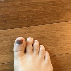 Surefoot