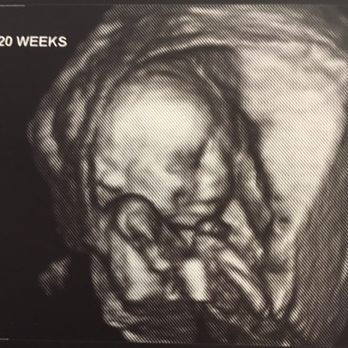 Babes & Bellies - Ultrasound Imaging Centers Near Me - Long Beach, California