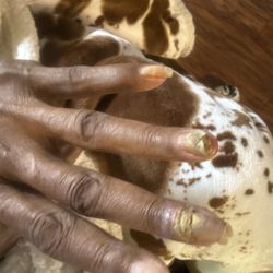 Lovely Nails - The nail fungus, my mom received from the salon