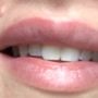 Photo of Bloom Facial Plastic Surgery