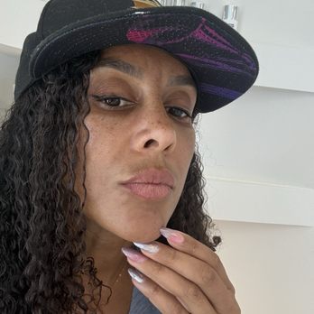 Contour Medical Spa - Before picture of my my last night on top of my lip and sun damage. - Medical Spas Near Me - Northridge, California Contour Medical Spa - Before picture of my my last night on top of my lip and sun damage. - Medical Spas Near Me - Northridge, California