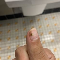 J & L Creative Nails - Tis the fungus among us