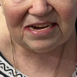 Mason Modern Dentistry - Dentures that were done horribly