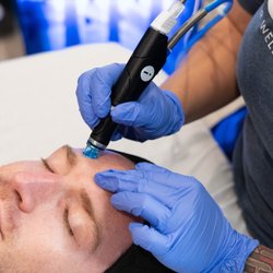 Restore Hyper Wellness - South Mt. Pleasant - Our Hydrafacial extracts impurities and exfoliates, then infuses restorative ingredients like nourishing antioxidant peptides.