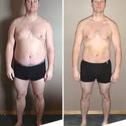 NOVU MD - This could be you in 30 days. Guy's loose weight twice as fast as girls so come in and have your summer body ready for the pool!