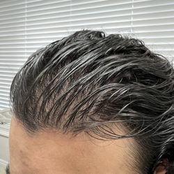 Porter Ranch Wellness Lounge - Full scalp prp