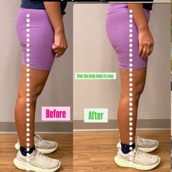 Holistic Muscle Therapy - Hypermobility hyperextension
