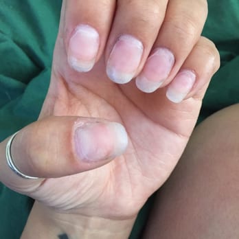 Sweet Paradise Nails - Took off polish to see how bad it was. - Nail Salons Near Me - Long Beach, California Sweet Paradise Nails - Took off polish to see how bad it was. - Nail Salons Near Me - Long Beach, California