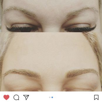 The Brow Nurse - Tattoo Removal Near Me - Redlands, California The Brow Nurse - Tattoo Removal Near Me - Redlands, California
