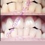 Photo of Pearly Whites and Ice