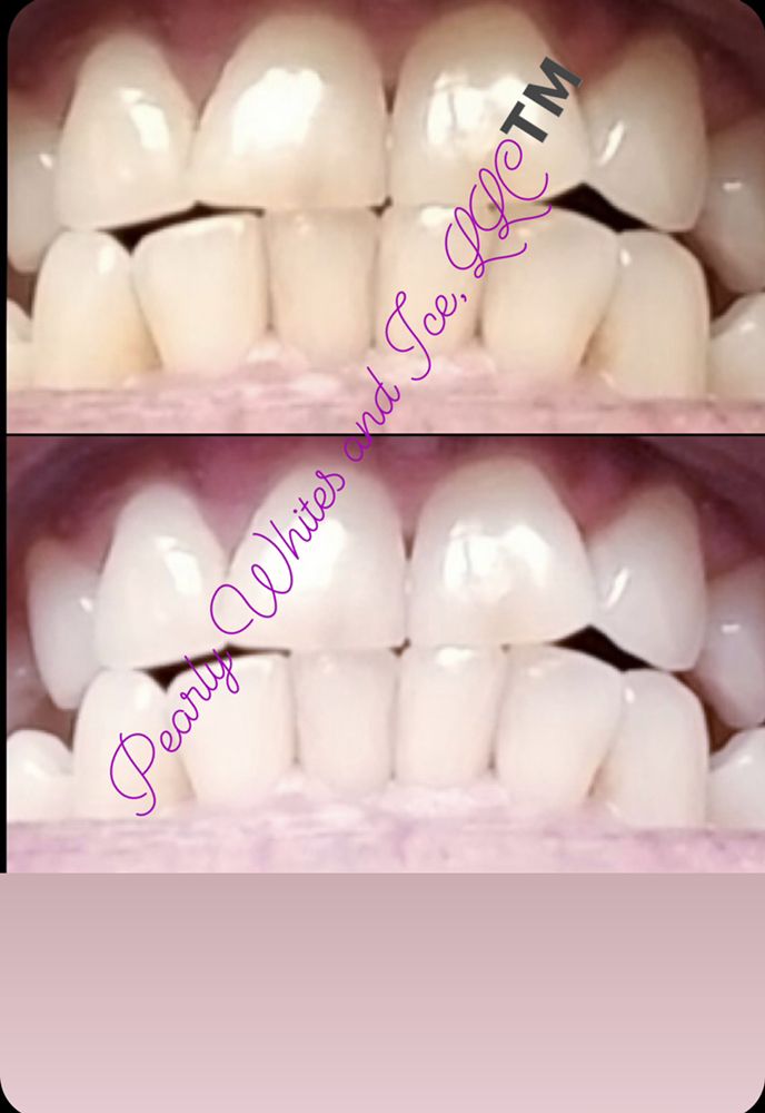Pearly Whites and Ice Logo