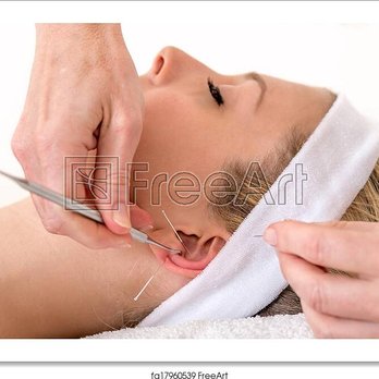 Texas Acupunture Center - Acupuncture Near Me - Pearland, Texas Texas Acupunture Center - Acupuncture Near Me - Pearland, Texas