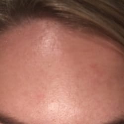 Spray tan not even