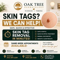 Say goodbye to unwanted skin tags! Safe, quick in-office removal. Same-week appointments available. Call today!