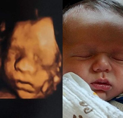 Baby's Debut 3d/4d Imaging